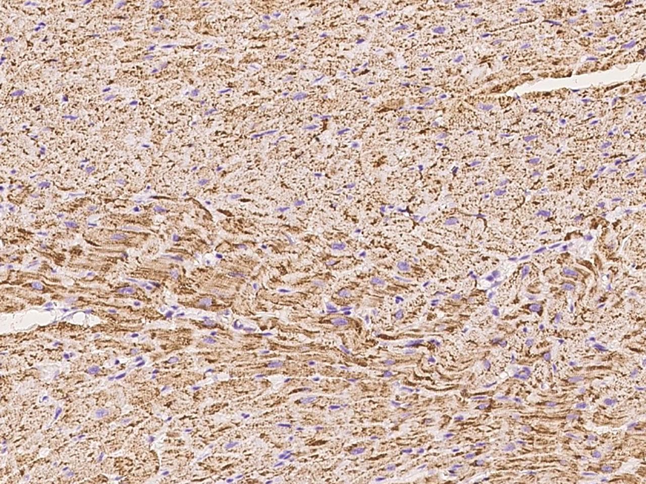 QCR2 / UQCRC2 Antibody