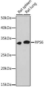 RPS6 / Ribosomal Protein S6 Antibody