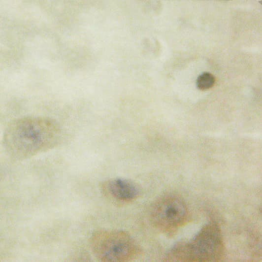 CAMK2B / CaMKII Beta Antibody
