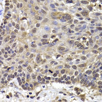 TTF2 / HuF2 Antibody