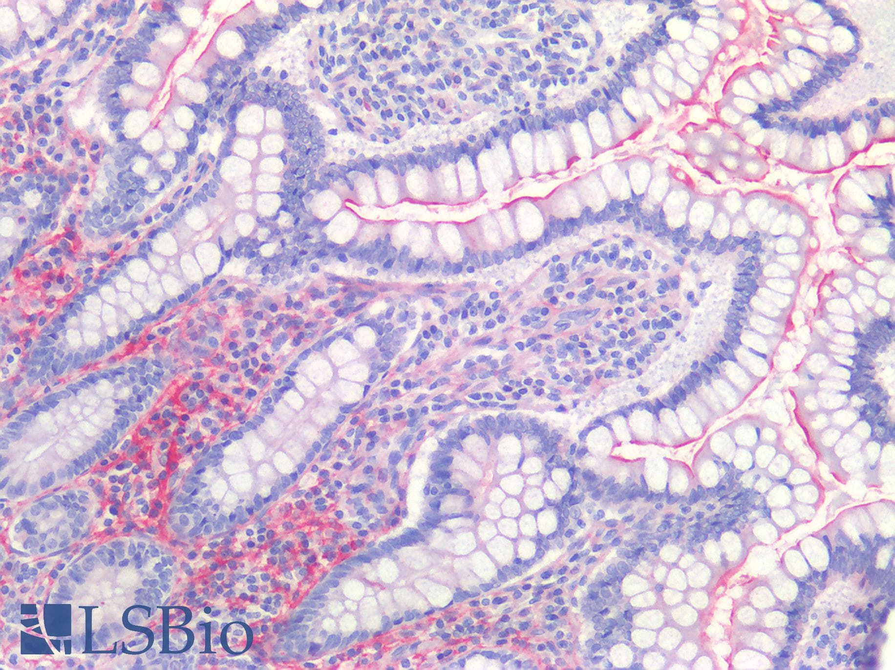 IHC-plus™ ACE2 / ACE-2 Antibody (aa773-805)