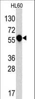 IHC-plus™ Polyclonal Rabbit anti-Human IL1R1 Antibody (aa474-503, IHC, WB)