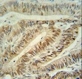 Polyclonal Rabbit anti-Human CUL5 / Cullin-5 Antibody (aa747-774, IHC, WB)