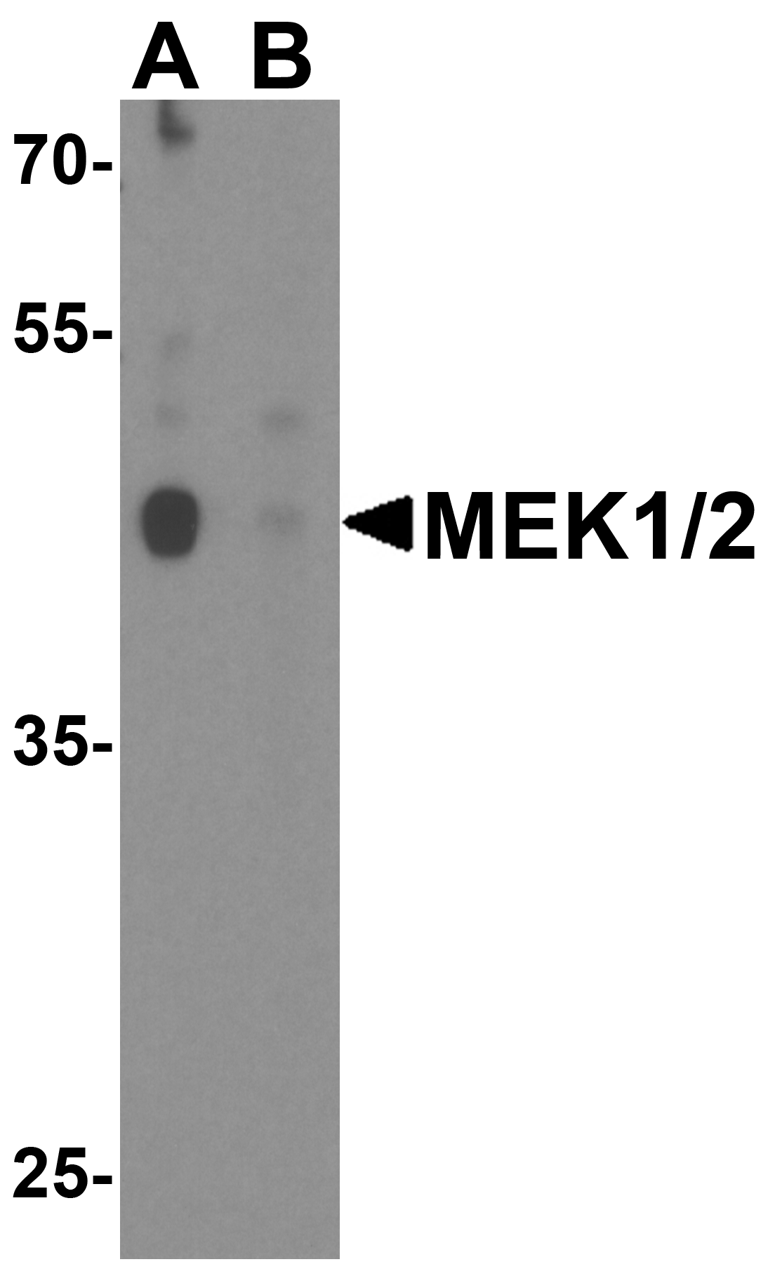 IHC-plus™ MEK1 + MEK2 Antibody