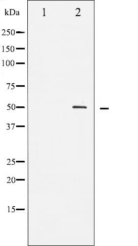 AML1 / RUNX1 Antibody (phospho-Ser303)