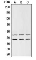 GSK3 Alpha+Beta Antibody (Internal)