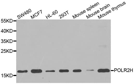 Polyclonal Rabbit anti-Human POLR2H / RPB8 Antibody (IHC, IF, WB)