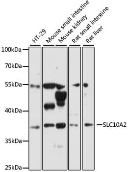 SLC10A2 / ASBT Antibody