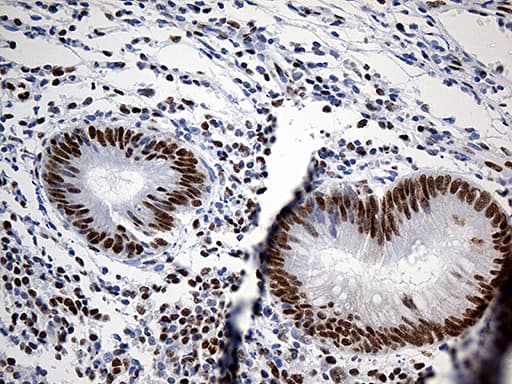 HNRNPH1 / hnRNP H Antibody (clone OTI5D11)