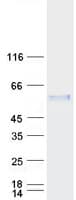 Human MEIS2 Protein (Recombinant Myc-DDK (Flag))
