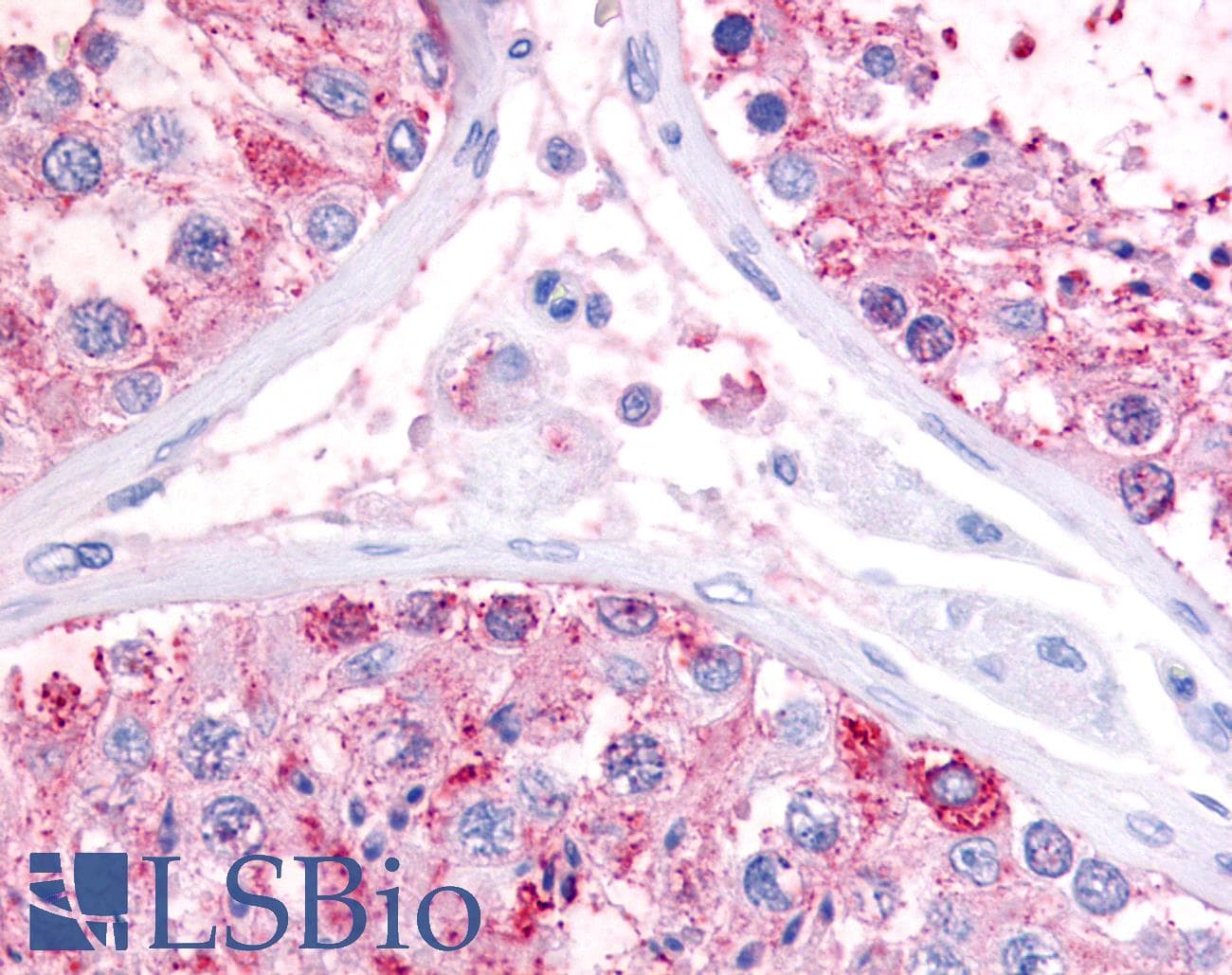 IHC-plus™ GPR22 Antibody (Cytoplasmic Domain)