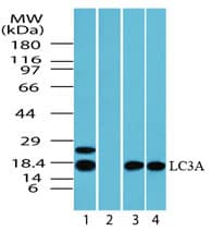 IHC-plus™ MAP1LC3A / LC3A Antibody (aa1-50)