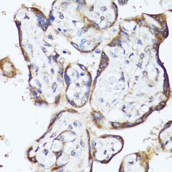 GKN1 / Gastrokine 1 Antibody