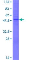 Human GPIHBP1 Protein (Recombinant GST)
