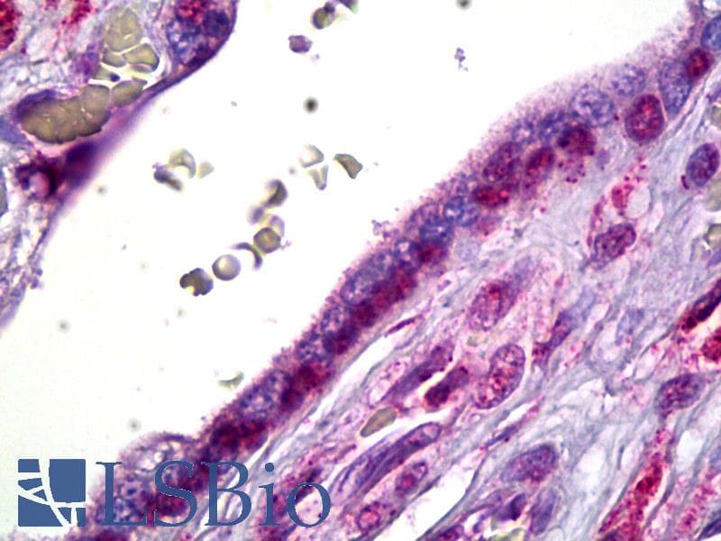 IHC-plus™ SMO / Smoothened Antibody (clone 3E5)