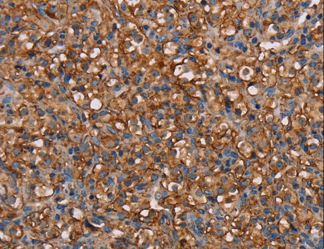 Polyclonal Rabbit anti-Human NEDD4L / NEDD4-2 Antibody (IHC)
