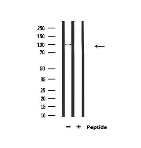 GRM4 / MGLUR4 Antibody