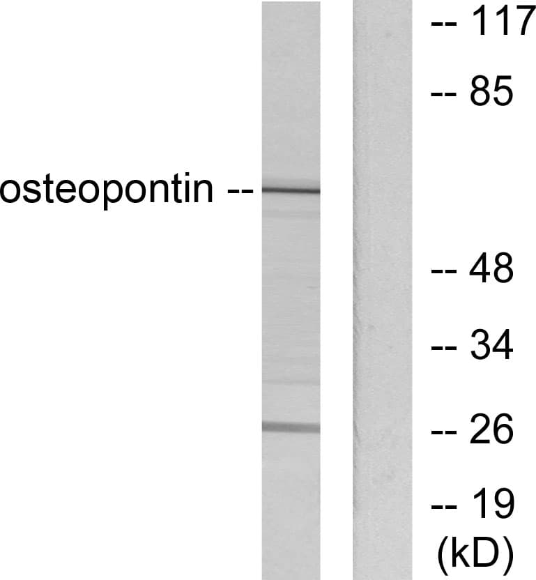 IHC-plus™ SPP1 / Osteopontin Antibody (aa261-310)