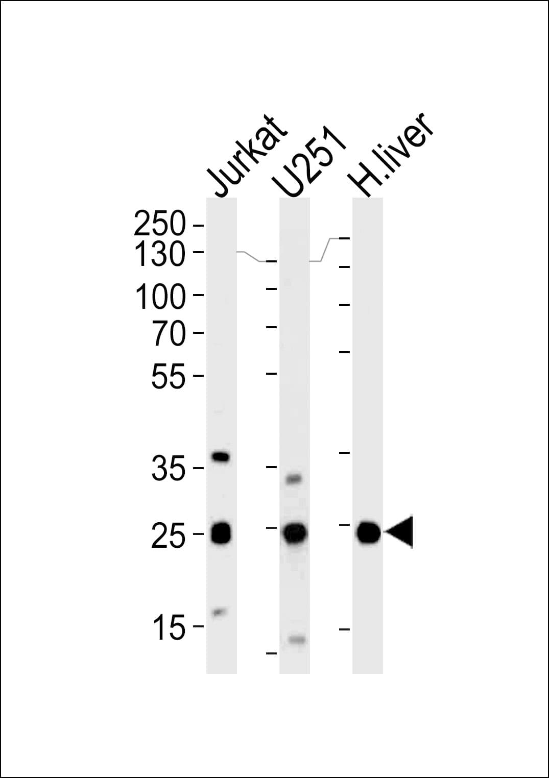 GSTM1 Antibody (aa184-211)