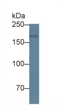 PAPPA / PAPP-A Antibody (aa1270-1558)