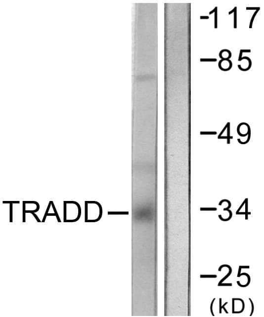 IHC-plus™ Polyclonal Rabbit anti-Human TRADD Antibody (aa251-300, IHC, WB)