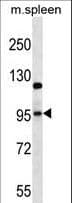 GRIA4 / GLUR4 Antibody (aa296-325)
