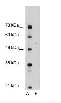 SEPSECS Antibody (aa61-110)