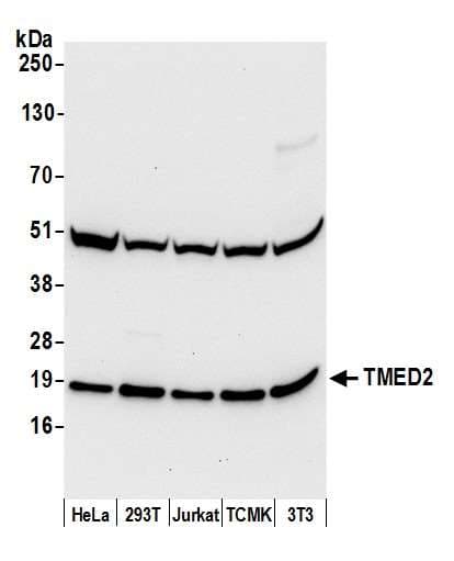 TMED2 Antibody (aa50-100)