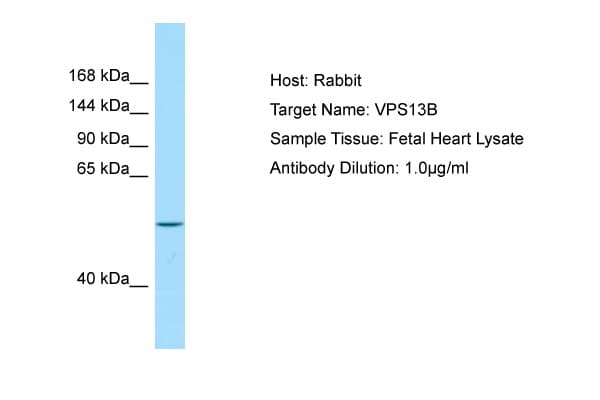 Polyclonal Rabbit anti-Human VPS13B Antibody (aa76-125, WB)