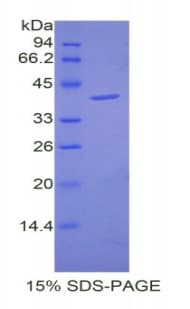 Mouse CCK / Cholecystokinin Protein (Recombinant His-GST)