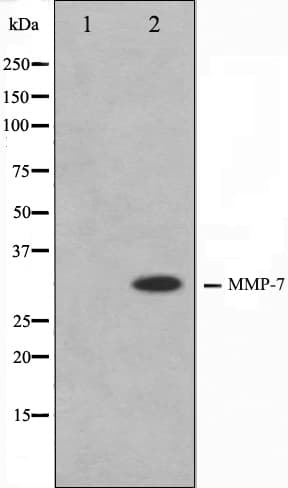 Polyclonal Rabbit anti-Human MMP7 / Matrilysin Antibody (IHC, IF, WB)