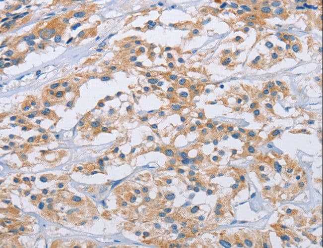 Polyclonal Rabbit anti-Human CCR9 / CD199 Antibody (IHC)
