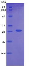 Mouse CTH / Cystathionase Protein (Recombinant His-T7)