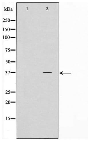 NPM1 / NPM / Nucleophosmin Antibody