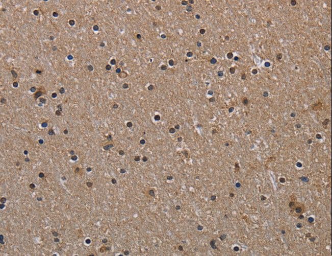 HIF1A / HIF1 Alpha Antibody