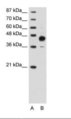 Polyclonal Rabbit anti-Human HOXC10 Antibody (N-Terminus, IHC, WB)