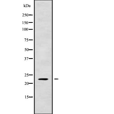 RAB1A Antibody