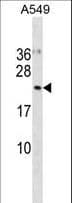 Polyclonal Rabbit anti-Human UFC1 Antibody (aa2-31, WB)