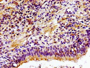 CHKA / CK / Choline Kinase Antibody