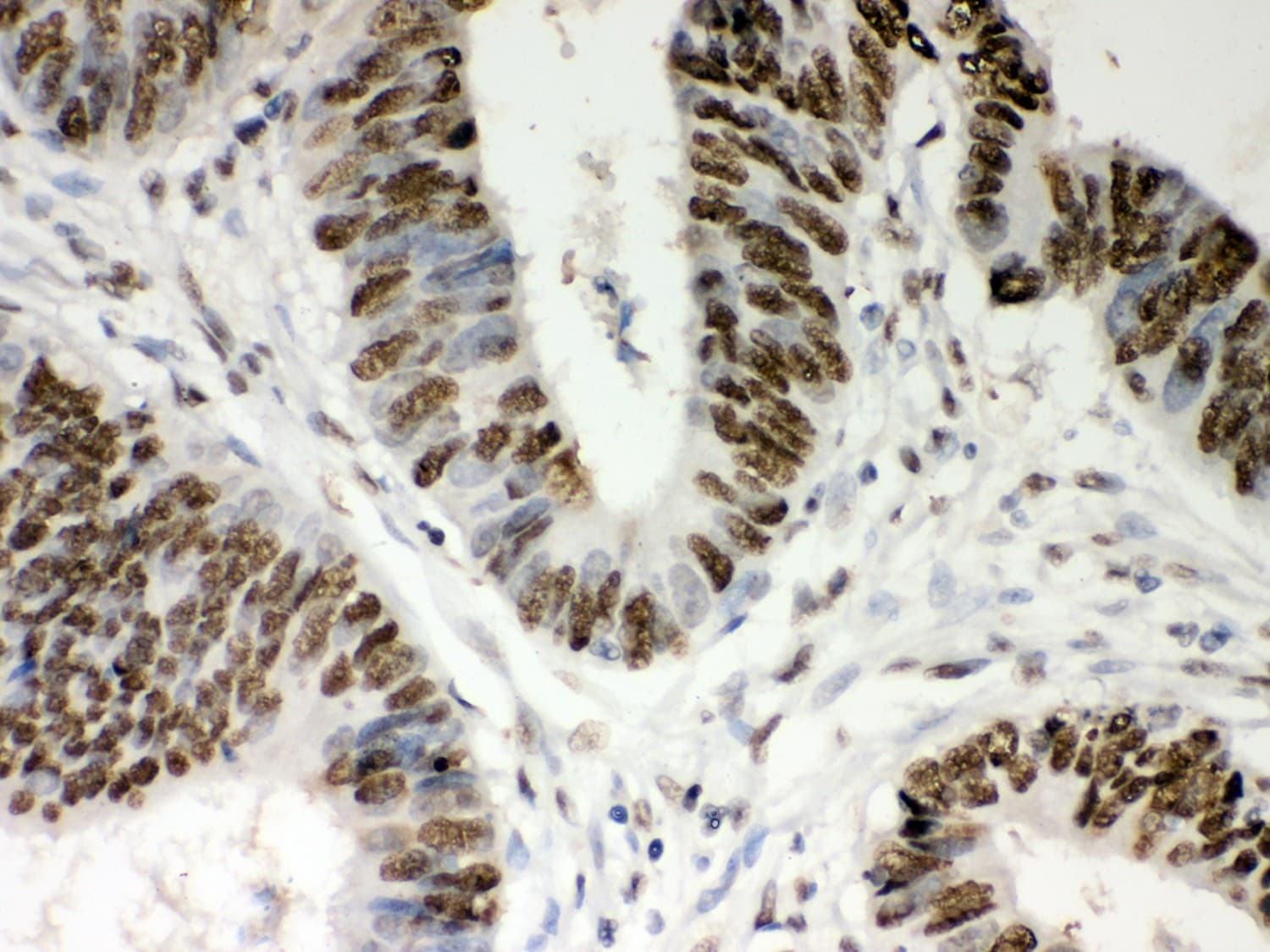 NPM1 / NPM / Nucleophosmin Antibody (aa1-294)
