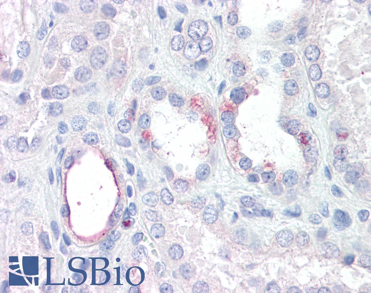 IHC-plus™ RHBG Antibody (aa203-212)