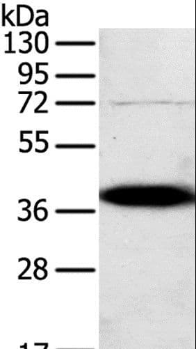 Osteonectin / SPARC Antibody (aa18-303)
