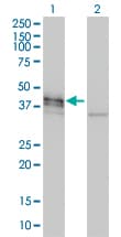 DCX / Doublecortin Antibody (clone 1G12)