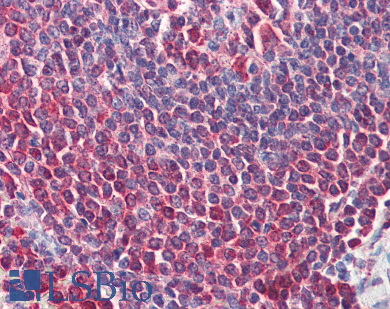 IHC-plus™ Monoclonal Mouse anti-Human TLR9 Antibody (FITC, aa268-284, IHC, WB)