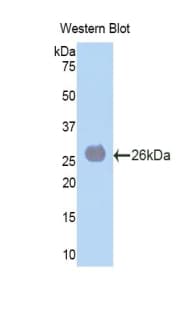 LAMA4 / Laminin Alpha 4 Antibody (aa745-940)