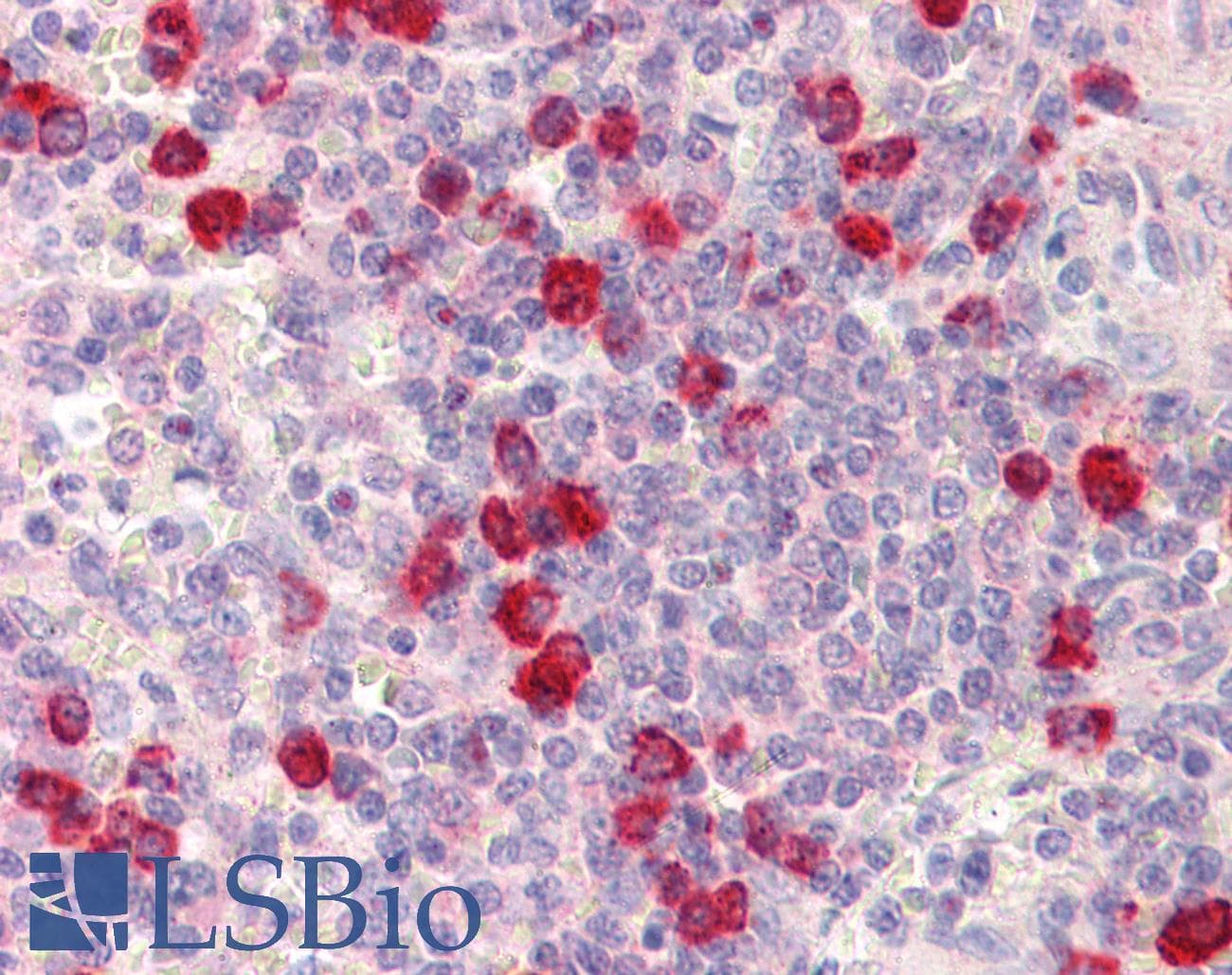IHC-plus™ ACOT11 / THEA Antibody (aa19-250, clone J4B2)