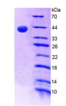 Human ALPL / Alkaline Phosphatase Protein (Recombinant His-T7)