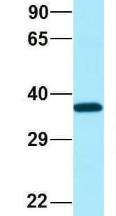 SCN4 / G6PC3 Antibody (aa86-135)
