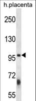 Polyclonal Rabbit anti-Human ZFYVE1 / DFCP1 Antibody (aa145-173, WB)