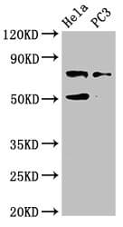GLB1 / Beta-Galactosidase Antibody